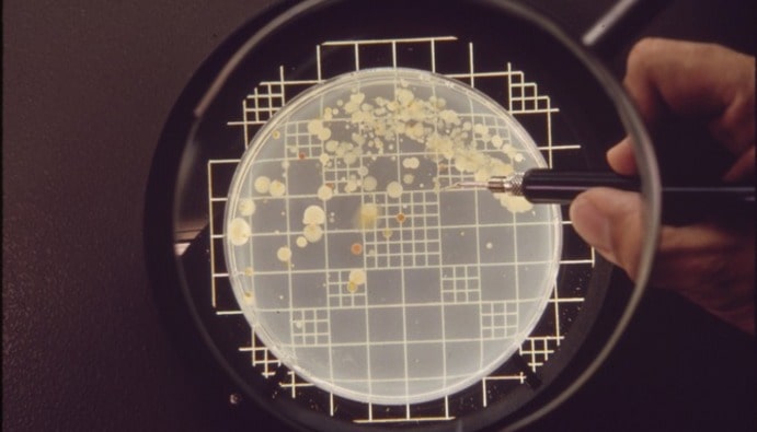 Yeast and Mold Count in Cosmetics